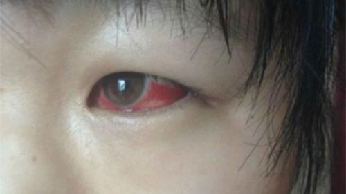 光觸媒除甲醛保護(hù)新裝修教室空氣，更保護(hù)孩子們